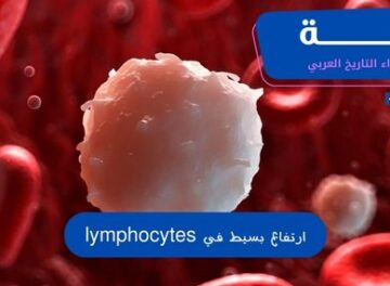 ارتفاع بسيط في lymphocytes